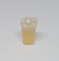 A27 #36N MOD Moderate Composite Resin Teeth with Caries Kilgore Teeth Nissin