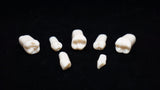 A5A-200#21 (3.4) Lower Left 1st Pre-molar Kilgore Teeth Nissin-A5A-200#21-Kilgore Int
