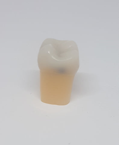 A27#16M 1.6 MO/OL Composite Resin Teeth with Caries Kilgore Teeth Nissin