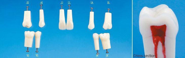 A22-200 (1.1) 8 - Upper Right Central Incisor Composite Resin Teeth with Hollow Pulp Kilgore Teeth Nissin-A22-200#8-Kilgore Int