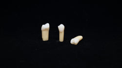 A27 #14G Composite Resin Teeth with Caries Kilgore Teeth Nissin-A27#14G-Kilgore Int