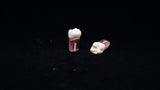 S12 #14 (2.6) Upper Left 1st Molar Endodontic Teeth with Transparent Root-S12#14-Kilgore Int