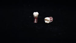 S12 #14 (2.6) Upper Left 1st Molar Endodontic Teeth with Transparent Root-S12#14-Kilgore Int