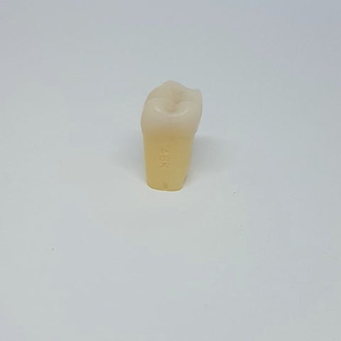 A27 #46K 4.6 MOD Minimal Composite Resin Teeth with Caries Kilgore Teeth Nissin