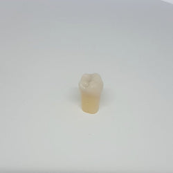 A27#36H 3.6 Class I 3 small caries (3.6) Composite Resin Teeth with Caries Kilgore Teeth Nissin